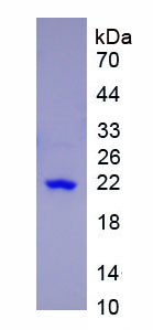 Eukaryotic Follicle Stimulating Hormone Beta (FSHb)