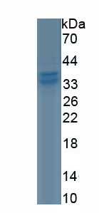 Eukaryotic Collagen Type II Alpha 1 (COL2a1)