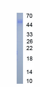 Eukaryotic Carboxylesterase 2 (CES2)