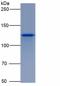 Eukaryotic NEL Like Protein 2 (NELL2)