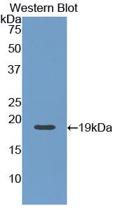 MAA008Hu22.jpg