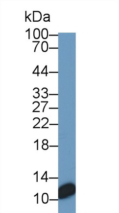 Monoclonal Antibody to S100 Calcium Binding Protein (S100)