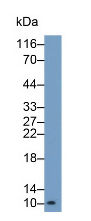 Monoclonal Antibody to S100 Calcium Binding Protein (S100)