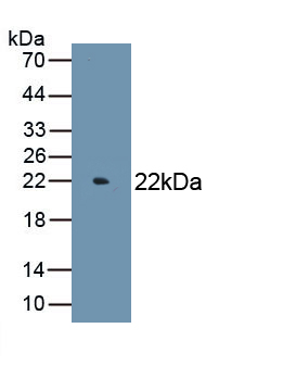 Monoclonal Antibody to Erythropoietin (EPO)