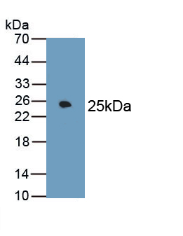 Monoclonal Antibody to Fibronectin (FN)