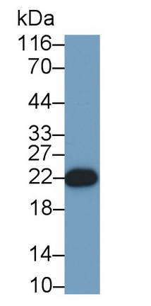 Monoclonal Antibody to Growth Hormone (GH)