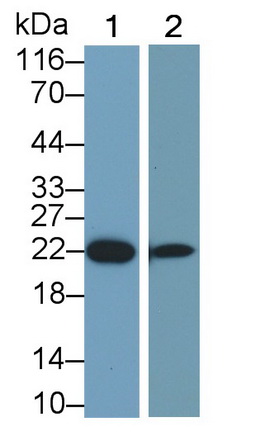 Monoclonal Antibody to Growth Hormone (GH)