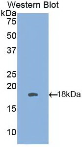 Monoclonal Antibody to Interferon Gamma (IFNg)