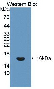 Monoclonal Antibody to Interferon Gamma (IFNg)