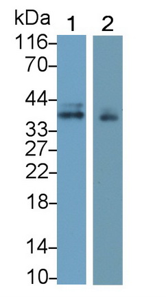 Monoclonal Antibody to Insulin Like Growth Factor Binding Protein 3 (IGFBP3)