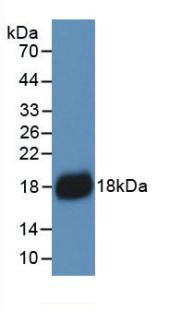 Monoclonal Antibody to Interleukin 18 (IL18)