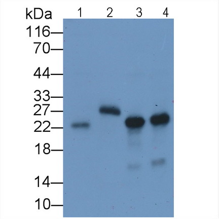 Monoclonal Antibody to Interleukin 18 (IL18)