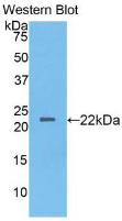 Monoclonal Antibody to Interleukin 2 (IL2)