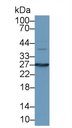 Monoclonal Antibody to Interleukin 6 (IL6)