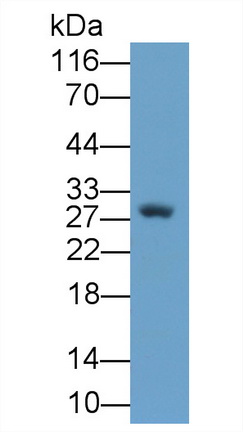 MAA105Hu23.jpg