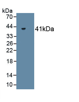 Monoclonal Antibody to Creatine Kinase, Muscle (CKM)