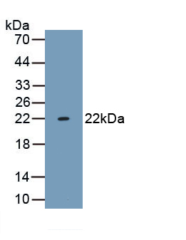 Monoclonal Antibody to Tumor Necrosis Factor Alpha (TNFa)