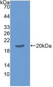 Monoclonal Antibody to Tumor Necrosis Factor Alpha (TNFa)