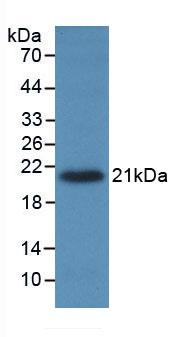 Monoclonal Antibody to Tumor Necrosis Factor Alpha (TNFa)