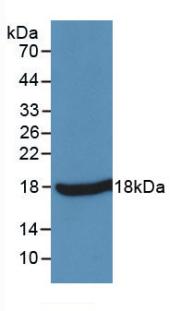 Monoclonal Antibody to Tumor Necrosis Factor Alpha (TNFa)