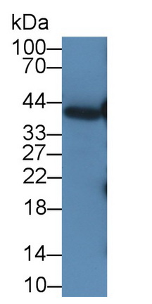 MAA165Hu27.jpg