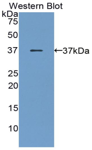 MAA166Hu22.jpg