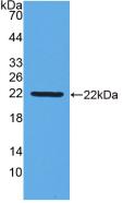 Monoclonal Antibody to Interferon Beta (IFNb)