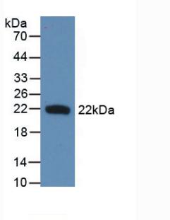 Monoclonal Antibody to Interferon Beta (IFNb)