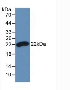 Monoclonal Antibody to Interferon Beta (IFNb)