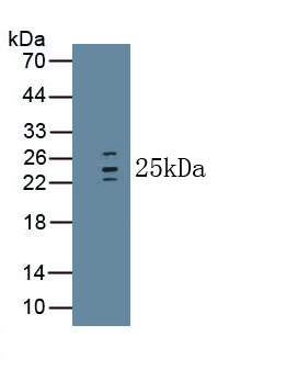 MAA223Hu26.jpg