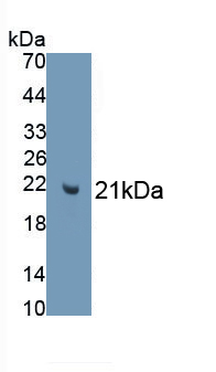 Monoclonal Antibody to Anti-Mullerian Hormone (AMH)