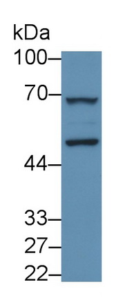 Monoclonal Antibody to Anti-Mullerian Hormone (AMH)