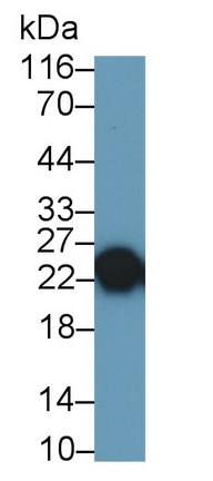 Monoclonal Antibody to Trypsin (TRY)