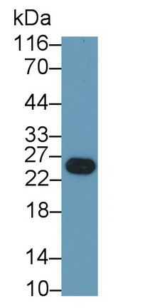 Monoclonal Antibody to Trypsin (TRY)