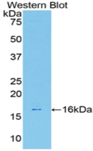 Monoclonal Antibody to Galectin 7 (GAL7)