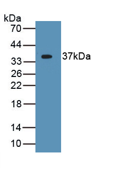 Monoclonal Antibody to Apolipoprotein H (APOH)