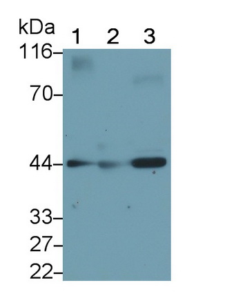 Monoclonal Antibody to Sex Hormone Binding Globulin (SHBG)