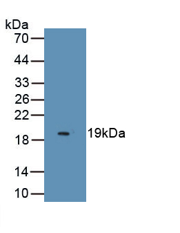 Monoclonal Antibody to Myelin Oligodendrocyte Glycoprotein (MOG)