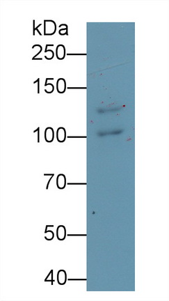 Monoclonal Antibody to Desmoglein 3 (DSG3)