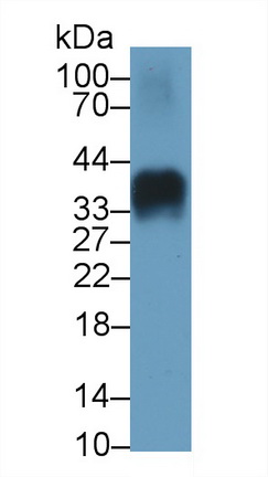 Monoclonal Antibody to Insulin (INS)