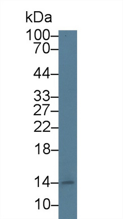 Monoclonal Antibody to N-Terminal Pro-Brain Natriuretic Peptide (NT-ProBNP)