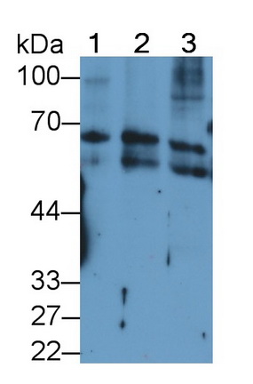 Monoclonal Antibody to Keratin 2 (CK2)