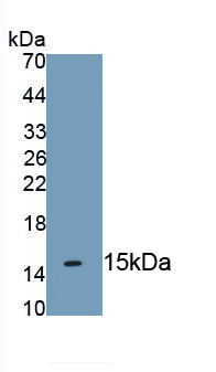 Monoclonal Antibody to Keratin 2 (CK2)