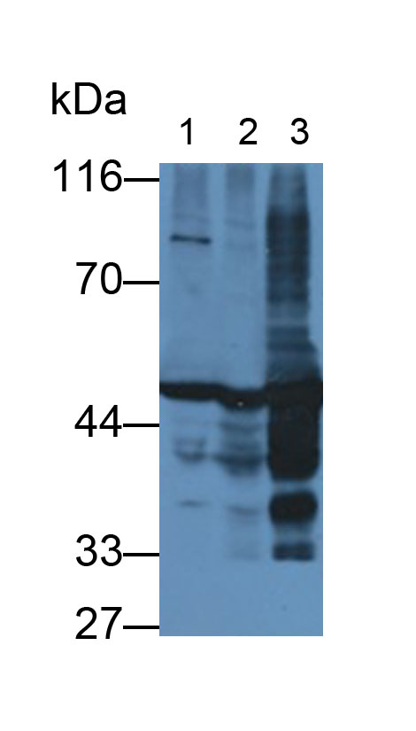 MAA537Hu28.jpg