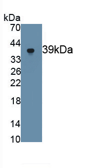 Monoclonal Antibody to Myelin Basic Protein (MBP)