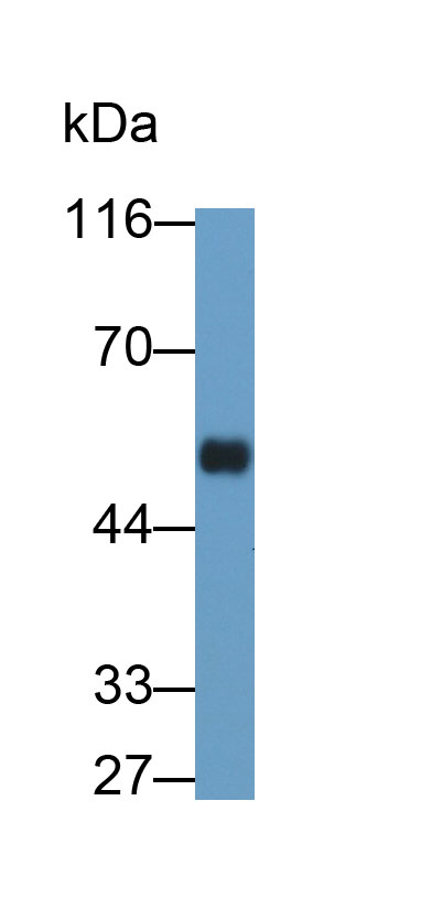 MAA544Hu22.jpg