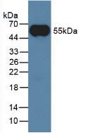 Monoclonal Antibody to Immunoglobulin G (IgG)