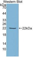 Monoclonal Antibody to Tissue Inhibitors Of Metalloproteinase 1 (TIMP1)