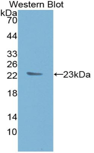 Monoclonal Antibody to Tissue Inhibitors Of Metalloproteinase 1 (TIMP1)