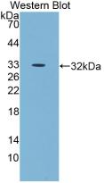 Monoclonal Antibody to Epidermal Growth Factor (EGF)